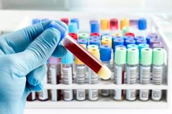 Разрабатывается новый тест для ранней диагностики риска развития лейкемии и других раков крови
